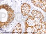 Desmoglein 1/2 Antibody in Immunohistochemistry (Paraffin) (IHC (P))