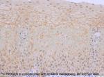 Plakoglobin Antibody in Immunohistochemistry (Paraffin) (IHC (P))