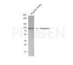 Plakoglobin Antibody in Western Blot (WB)