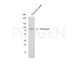 Plakoglobin Antibody in Western Blot (WB)