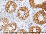 Cytokeratin 19 Antibody in Immunohistochemistry (IHC)