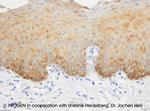 Cytokeratin 19 Antibody in Immunohistochemistry (IHC)