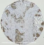 Cytokeratin 19 Antibody in Immunohistochemistry (IHC)