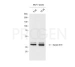 Cytokeratin 19 Antibody in Western Blot (WB)