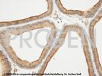 Cytokeratin 17 Antibody in Immunohistochemistry (IHC)