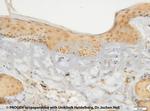 Cytokeratin 17 Antibody in Immunohistochemistry (IHC)