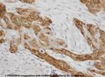 Cytokeratin 17 Antibody in Immunohistochemistry (IHC)