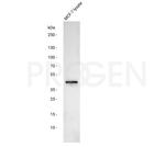 Cytokeratin 17 Antibody in Western Blot (WB)