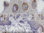 Keratin K6 Antibody in Immunohistochemistry (Paraffin) (IHC (P))