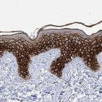 Desmocollin 3 Antibody in Immunohistochemistry (IHC)