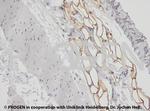 Adipophilin Antibody in Immunohistochemistry (IHC)