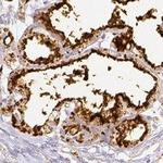 Adipophilin Antibody in Immunohistochemistry (IHC)