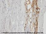 Adipophilin Antibody in Immunohistochemistry (IHC)