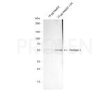 Adipophilin Antibody in Western Blot (WB)