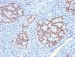 HNF1A (Pancreatic Tumor Suppressor) Antibody in Immunohistochemistry (Paraffin) (IHC (P))