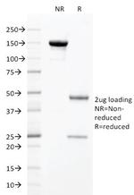 HNF1A (Pancreatic Tumor Suppressor) Antibody in SDS-PAGE (SDS-PAGE)