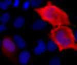 6x-His Tag Antibody in Immunocytochemistry (ICC/IF)