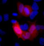 6x-His Tag Antibody in Immunocytochemistry (ICC/IF)