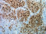 Phospho-ERK1/ERK2 (Thr185, Tyr187) Antibody in Immunohistochemistry (Paraffin) (IHC (P))