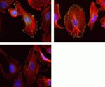 Phospho-FAK (Tyr576) Antibody in Immunocytochemistry (ICC/IF)