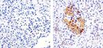 IRAK1 Antibody in Immunohistochemistry (Paraffin) (IHC (P))