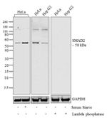 Phospho-SMAD2 (Thr8) Antibody in Western Blot (WB)