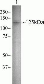 Vinculin Antibody in Western Blot (WB)