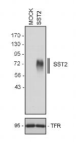 SSTR2 Antibody in Western Blot (WB)