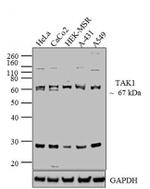 TAK1 Antibody in Western Blot (WB)