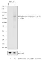Phospho-Zap-70 (Tyr315, Tyr319) Antibody in Western Blot (WB)