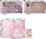 Claudin 18 Antibody in Immunohistochemistry (Paraffin) (IHC (P))