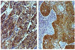 Claudin 18 Antibody in Immunohistochemistry (Paraffin) (IHC (P))