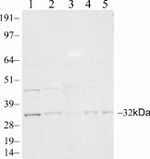 PSME3 Antibody in Western Blot (WB)