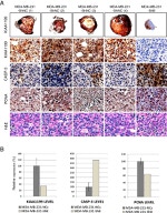 Caspase 3 Antibody in Immunohistochemistry (IHC)