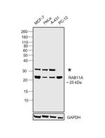 RAB11A Antibody in Western Blot (WB)