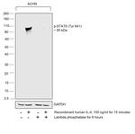 Phospho-STAT6 (Tyr641) Antibody