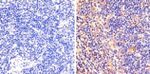 Phospho-STAT6 (Tyr641) Antibody in Immunohistochemistry (Paraffin) (IHC (P))