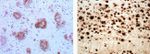 beta Amyloid Antibody in Immunohistochemistry (Paraffin) (IHC (P))