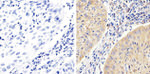 Phospho-FAK (Tyr397) Antibody in Immunohistochemistry (Paraffin) (IHC (P))