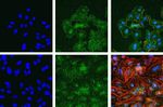 Phospho-FAK (Tyr397) Antibody in Immunocytochemistry (ICC/IF)