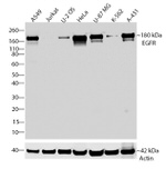 EGFR Antibody in Western Blot (WB)