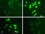 Phospho-STAT1 (Tyr701) Antibody