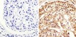 Phospho-STAT1 (Tyr701) Antibody in Immunohistochemistry (Paraffin) (IHC (P))