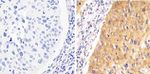 Phospho-STAT1 (Tyr701) Antibody in Immunohistochemistry (Paraffin) (IHC (P))