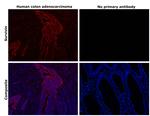 Survivin Antibody in Immunohistochemistry (Paraffin) (IHC (P))