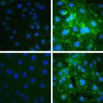 Phospho-AKT1 (Ser473) Antibody in Immunocytochemistry (ICC/IF)