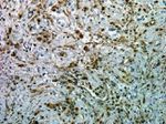 Phospho-AKT1 (Ser473) Antibody in Immunohistochemistry (Paraffin) (IHC (P))