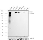 ErbB2 (HER-2) Antibody