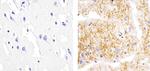 IRS1 Antibody in Immunohistochemistry (Paraffin) (IHC (P))