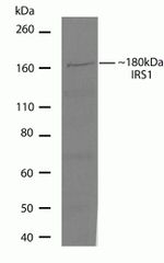 IRS1 Antibody in Western Blot (WB)